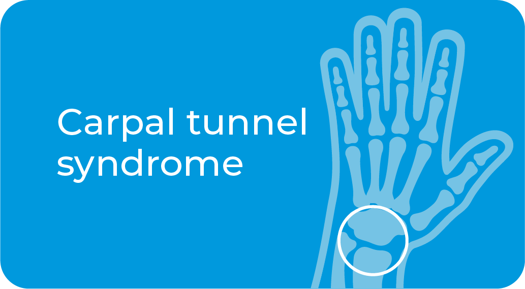 Carpal tunel syndrome