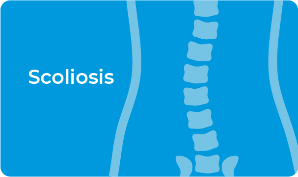 scoliosis