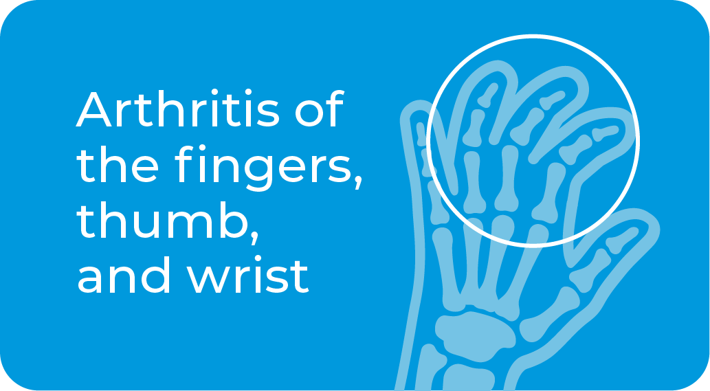 Arthritis of the fingers, thumb, wrist