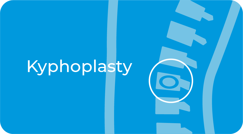 Kyphoplasty