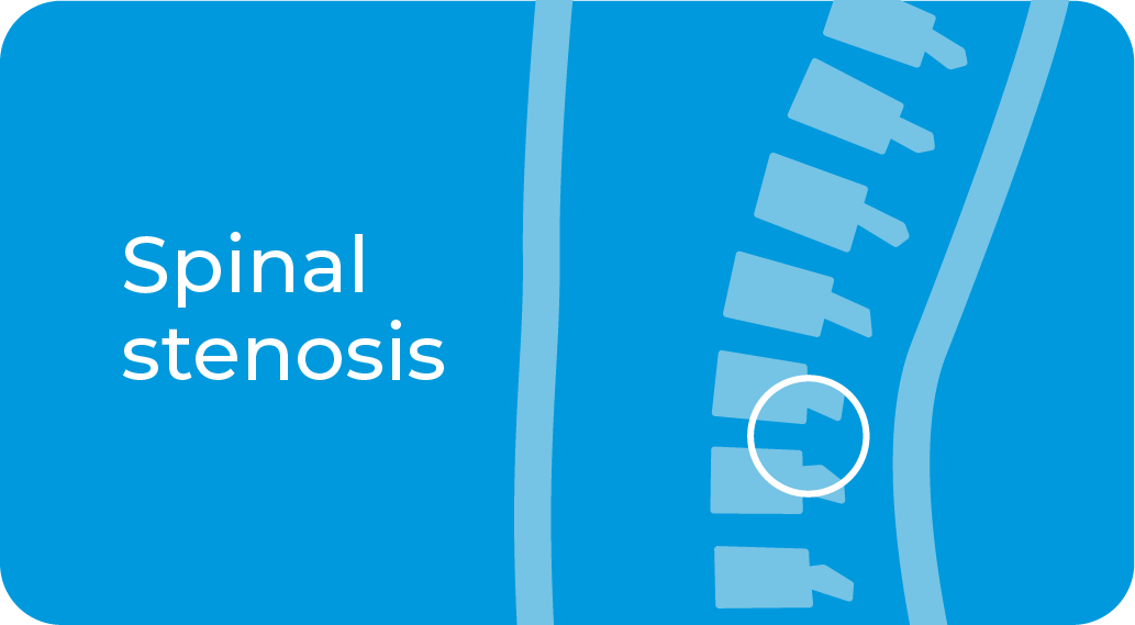 Spinal stenosis