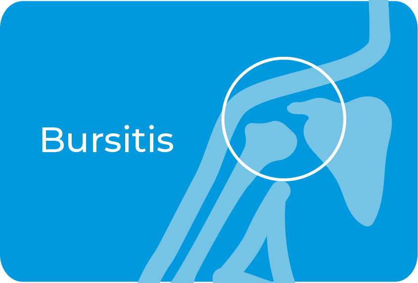 Bursitis