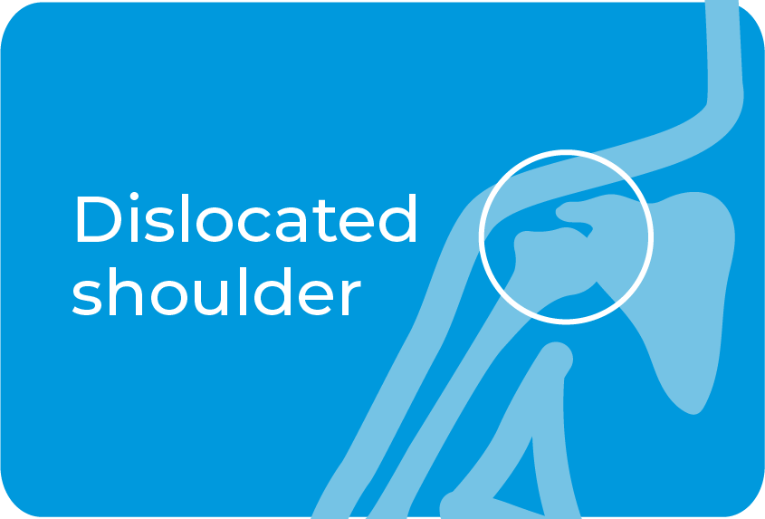 Dislocated shoulder