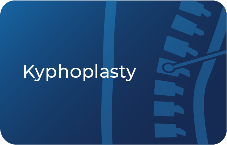 kyphoplasty